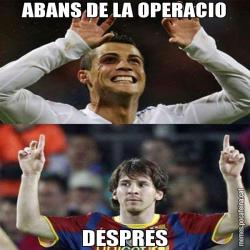 ABANS DE LA OPERACIO DESPRES
