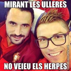 MIRANT LES ULLERES NO VEIEU ELS HERPES