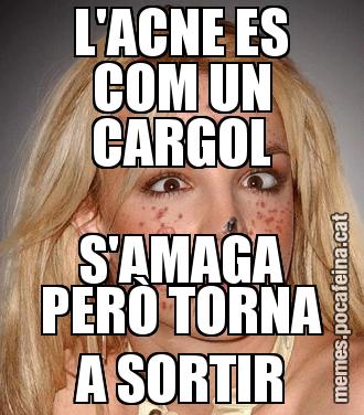 L'ACNE ES COM UN CARGOL S'AMAGA PERÒ TORNA A SORTIR